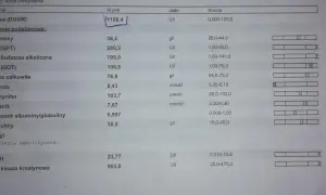 Wynik lipazy u psa 1158,4 U/I znacznie przekracza normę 0-120 U/I, co może wskazywać na problemy zdrowotne.