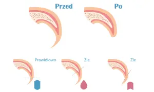 Ilustracja pokazuje, jak obciąć psu pazury. Prawidłowe cięcie jest pokazane z niebieskim kształtem, a złe cięcie z krwawiącą kroplą lub strzałką.
