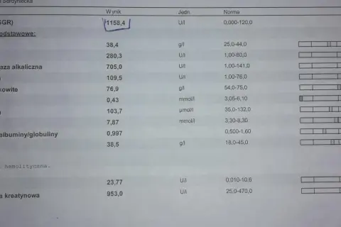 Wynik lipazy u psa 1158,4 U/I znacznie przekracza normę 0-120 U/I, co może wskazywać na problemy zdrowotne.