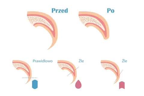 Ilustracja pokazuje, jak obciąć psu pazury. Prawidłowe cięcie jest pokazane z niebieskim kształtem, a złe cięcie z krwawiącą kroplą lub strzałką.