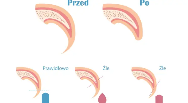 Ilustracja pokazuje, jak obciąć psu pazury. Prawidłowe cięcie jest pokazane z niebieskim kształtem, a złe cięcie z krwawiącą kroplą lub strzałką.